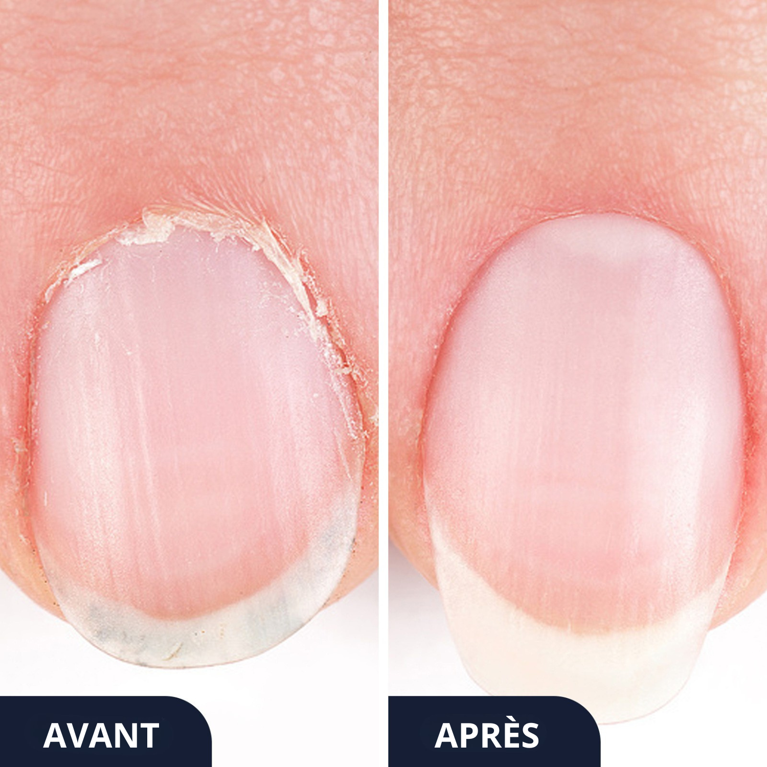 GlowFeet™ - Mon stylo bien-être pour des ongles parfaits