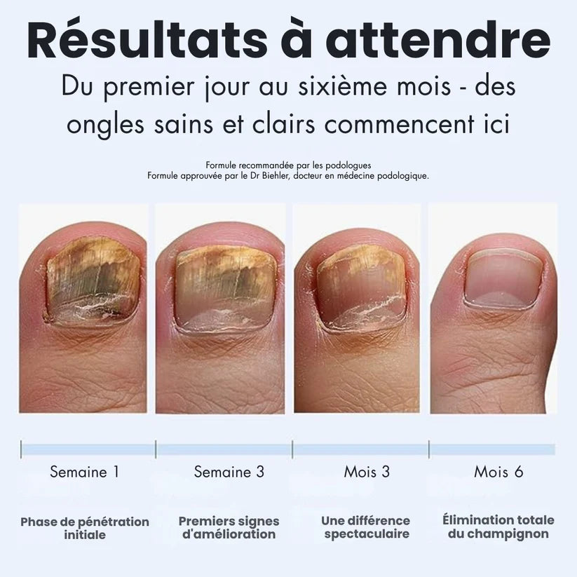 GlowFeet™ - Mon stylo bien-être pour des ongles parfaits