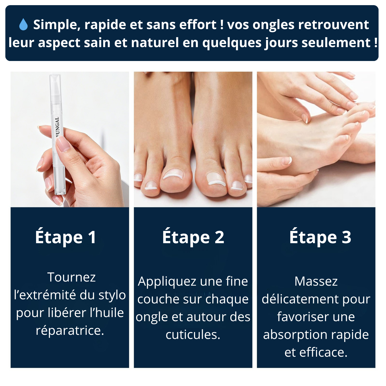 GlowFeet™ - Mon stylo bien-être pour des ongles parfaits